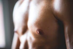 Adult Gynecomastia Surgery San Jose