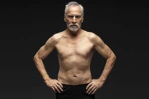 Senior Gynecomastia Surgery San Jose